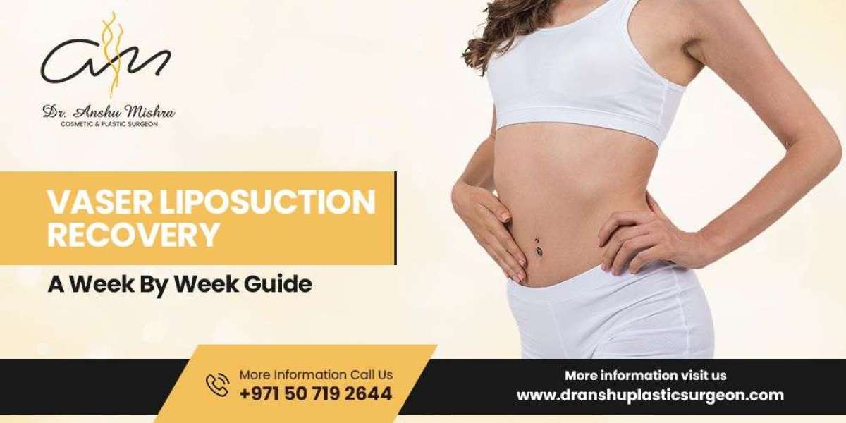 Smooth Recovery After VASER Liposuction: What You Need to Know