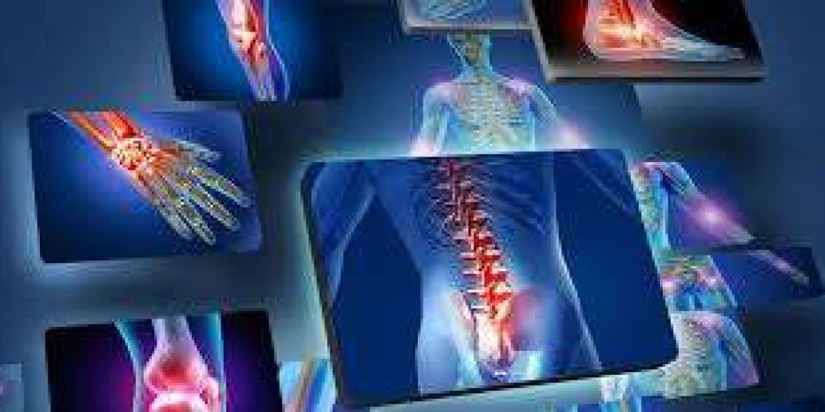 How Effective Is Somadril 350 mg as a Muscle Relaxer?