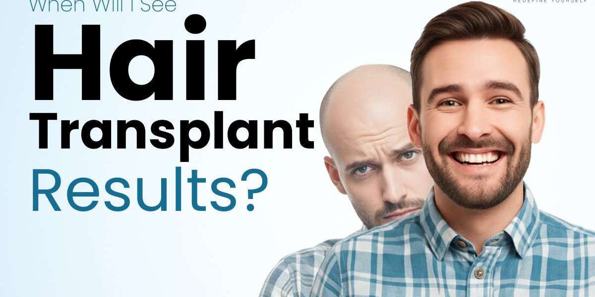 Dr. Gaurav Garg: Hair Transplant Center in New Delhi: Cost, Clinics and Expert Care by Dermalife.