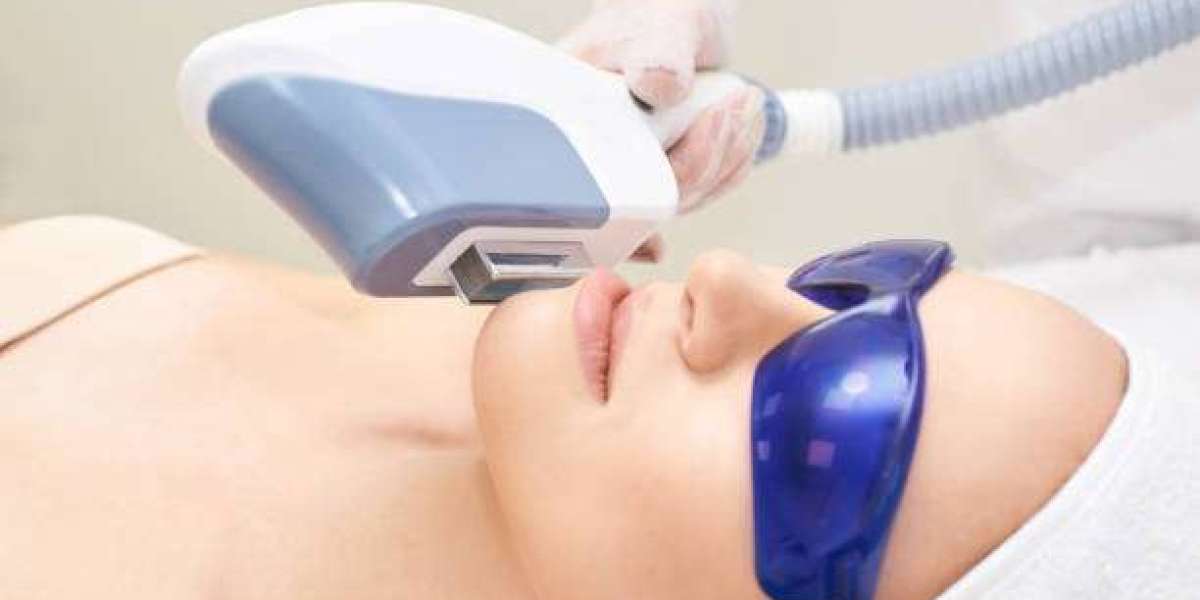 Laser Hair Reduction in Ludhiana – Smooth, Long-Lasting Results by Kyra Aesthetic Clinic