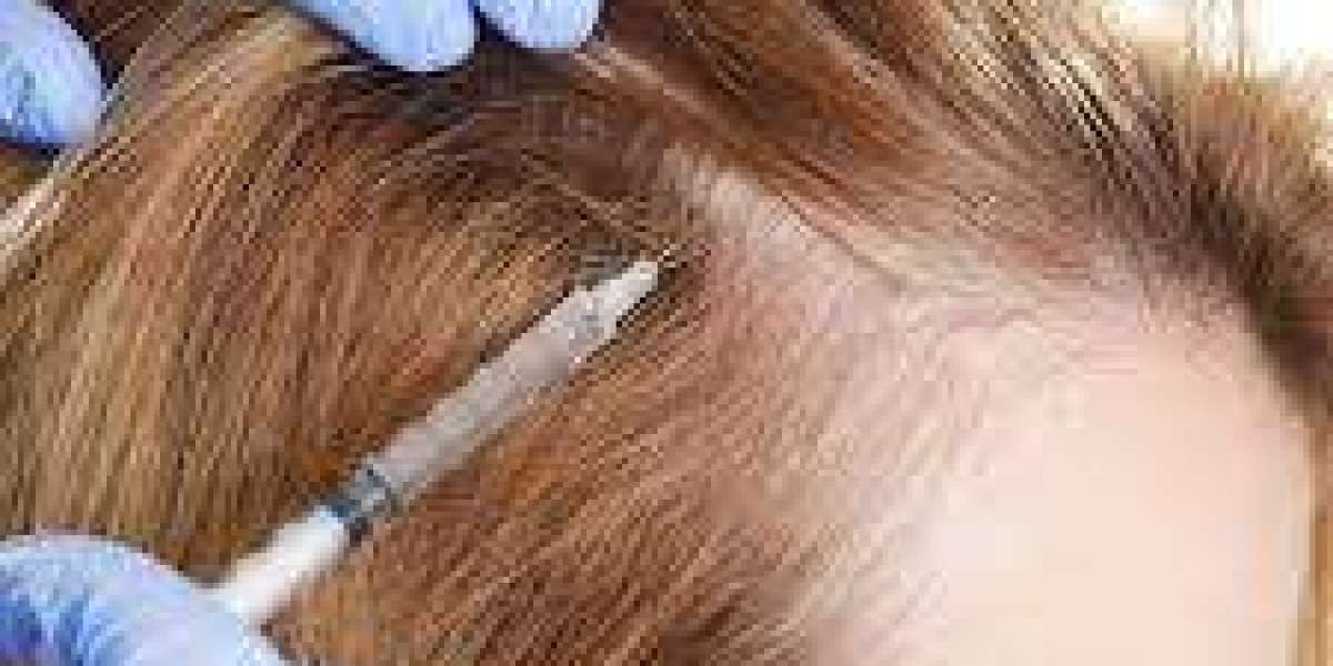 PRP in Dubai – Natural Skin and Hair Restoration
