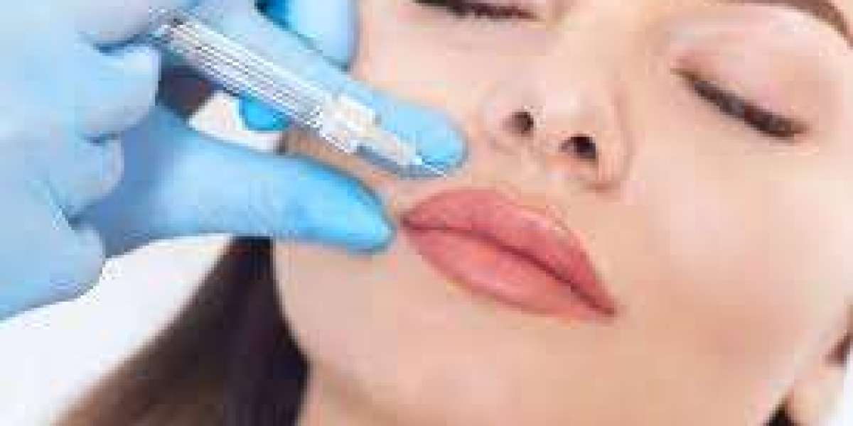 Thinking About Fillers? Start Your Journey with the Best Dermal Fillers in Chino Hills