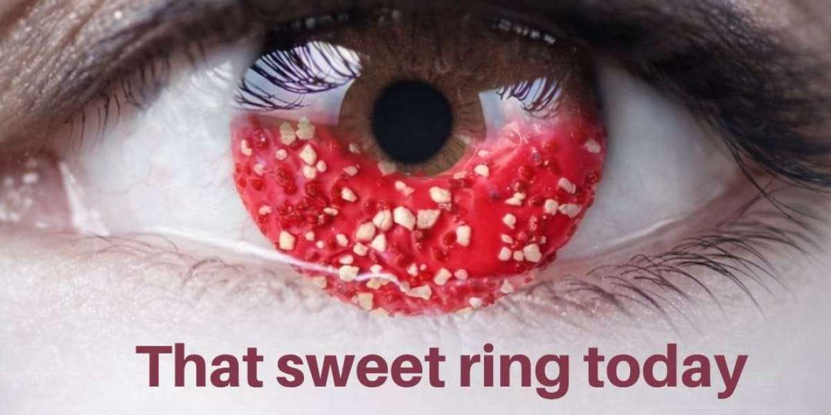 Best Eye Hospital Services in Raipur for Cataract, Lasik, and Squint Care