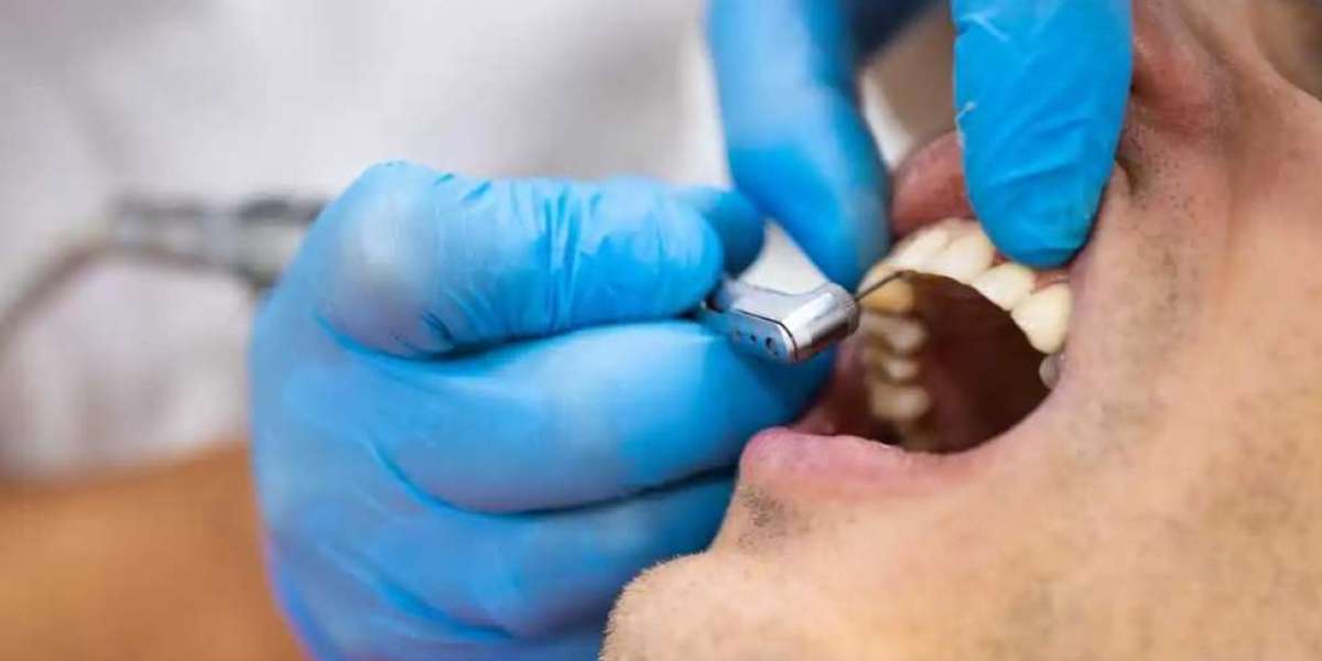 A Complete Guide to Safe and Professional Tooth Extraction Services