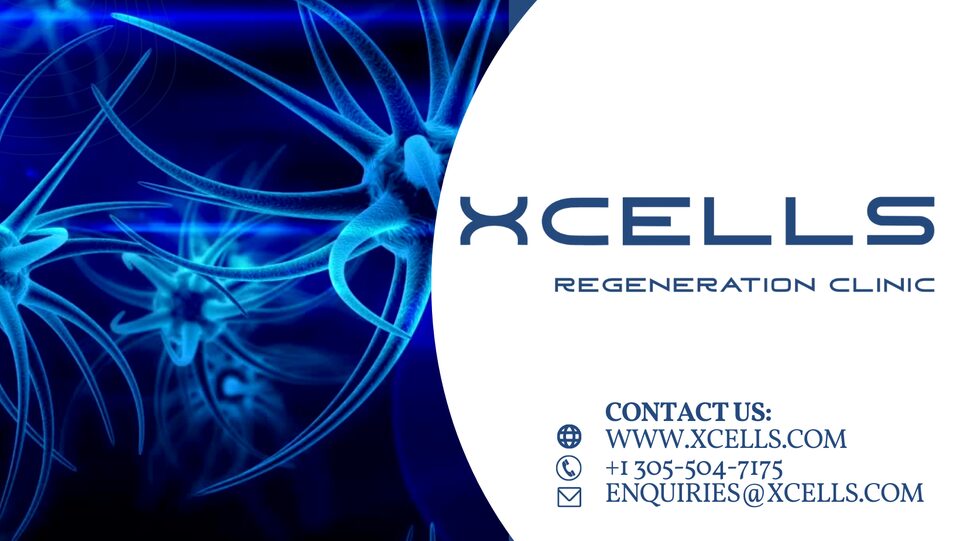 Advancing Brain Health Through Regenerative Innovation - Blogingers