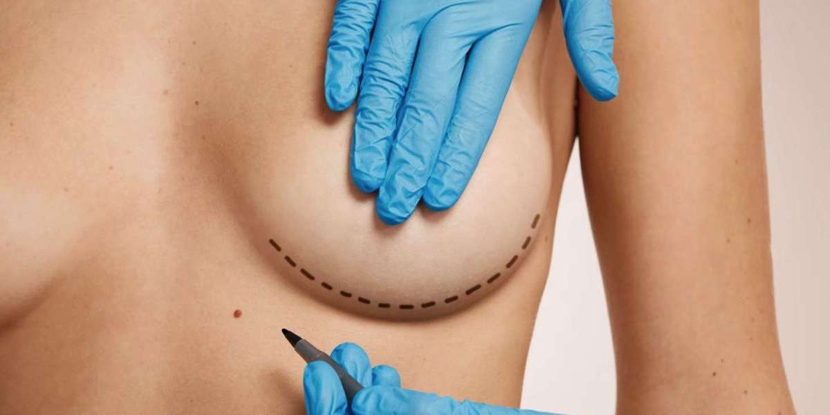 Breast Lift in Dubai: Scar Healing Tips and Scar Reduction Methods