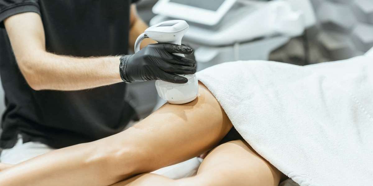 Muscle Sculpt: A Modern Guide to Body Definition and Non-Invasive Sculpting