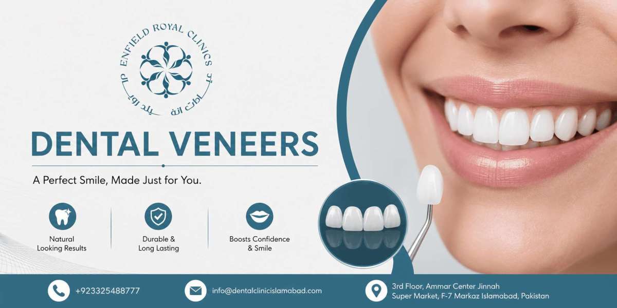 Dental Veneers in Islamabad – Beautiful Smiles Made Simple