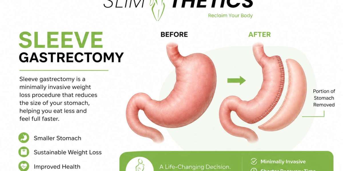 Who Is the Right Candidate for Sleeve Gastrectomy in Islamabad?