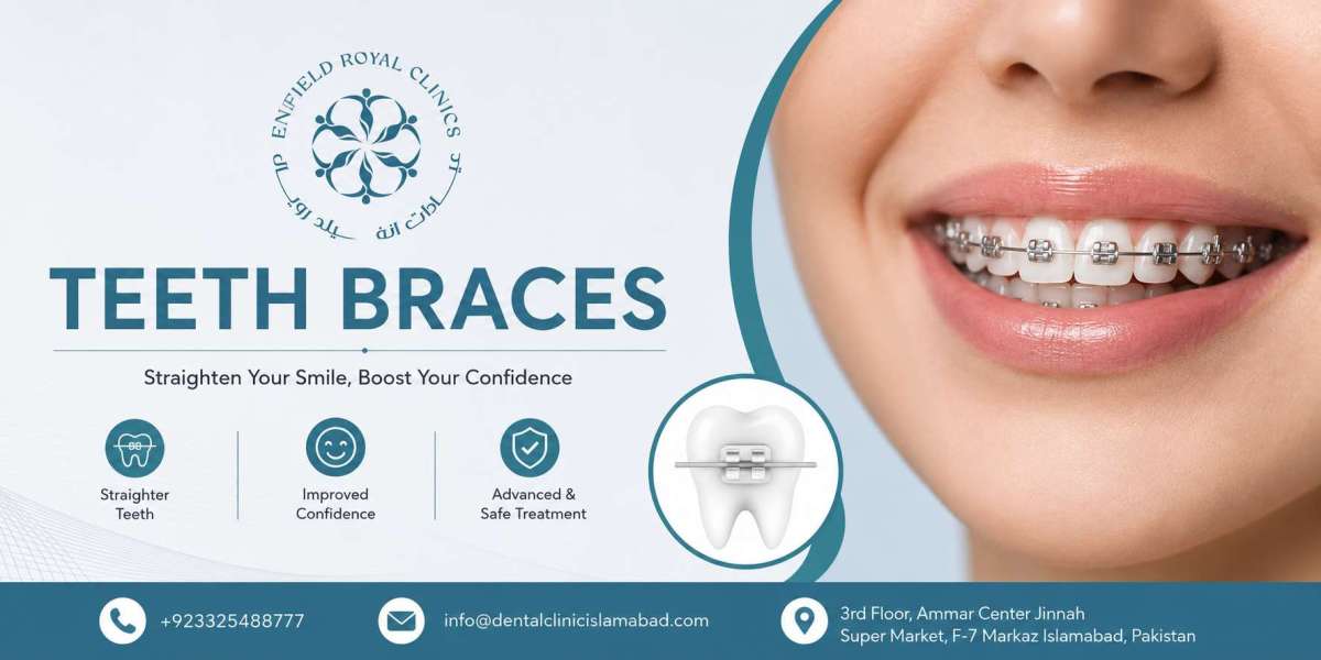 Discover the Benefits of Teeth Braces in Islamabad