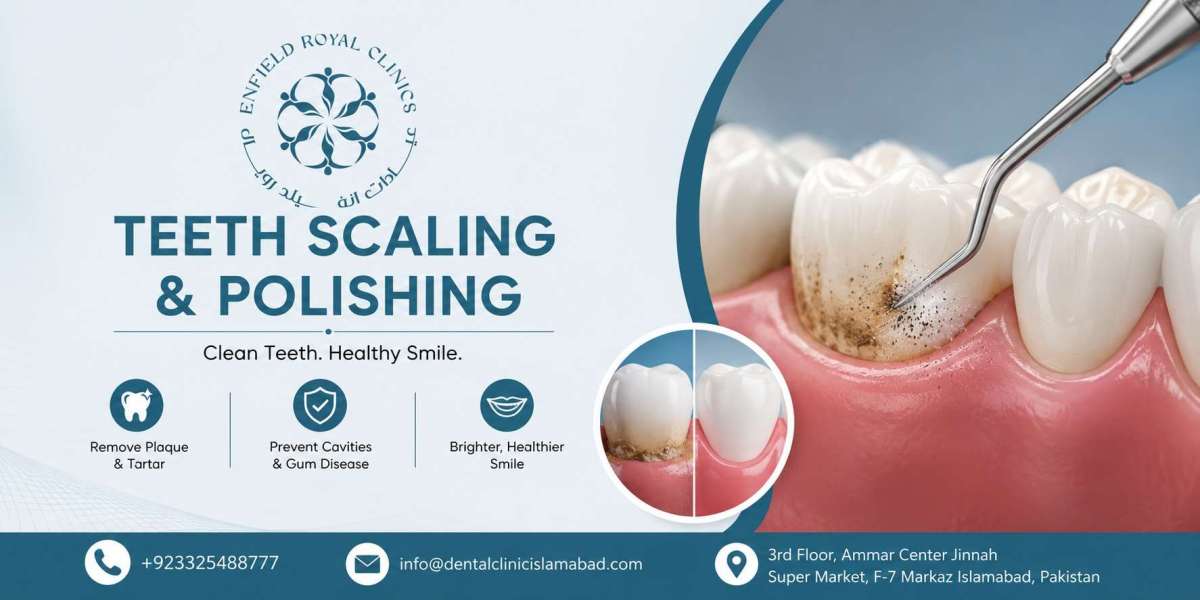 Premium Teeth Scaling and Polishing Islamabad