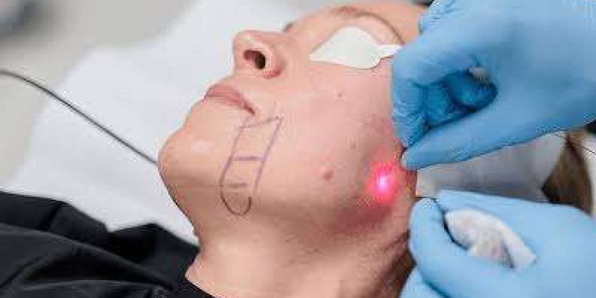 Non-surgical Face Lifting in Dubai: Lift and Refresh Without Downtime