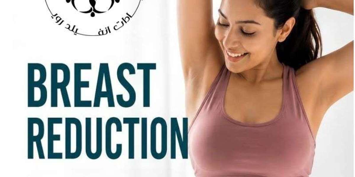 Breast Reduction in Islamabad: What to Expect Before, During and After Surgery