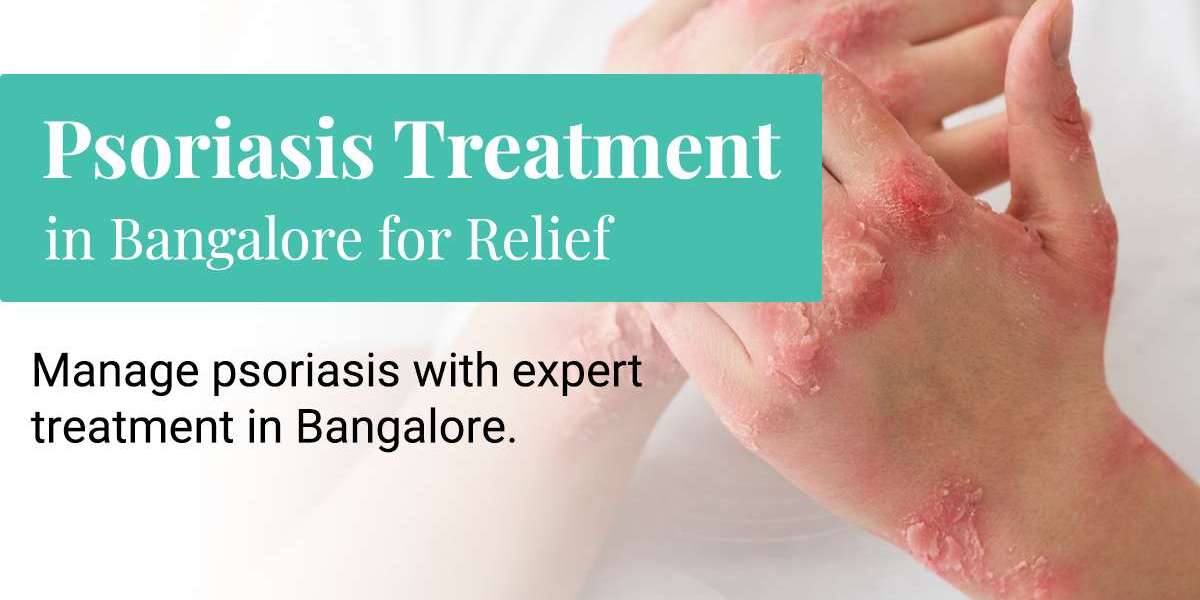 Can Psoriasis Be Controlled? Understanding Treatment, Triggers and Flare-Ups