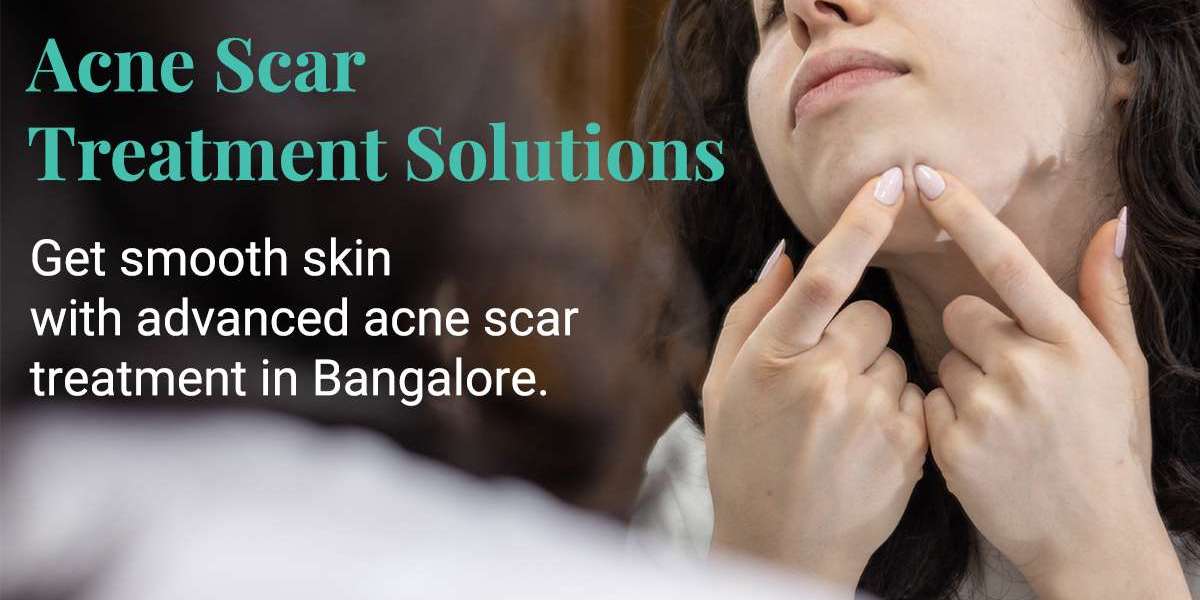 Acne Scar Reduction: Why One Treatment Cannot Work for Every Scar